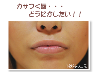 �̌��O�̌����@�u�J�T���O�E�E�E�ǂ��ɂ��������I�I�v