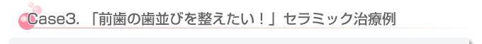 歯並びを整えたい方のセラミック症例