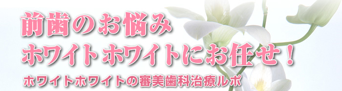 前歯のお悩みホワイトホワイトにおまかせ
