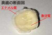 奥歯の歯の断面図 奥歯の歯の断面図