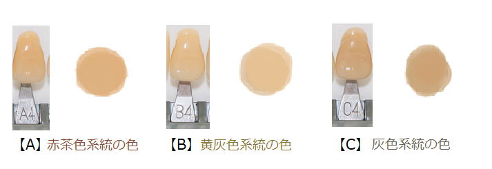 歯の色の系統と色の濃さの分類 歯の色の系統と色の濃さの分類