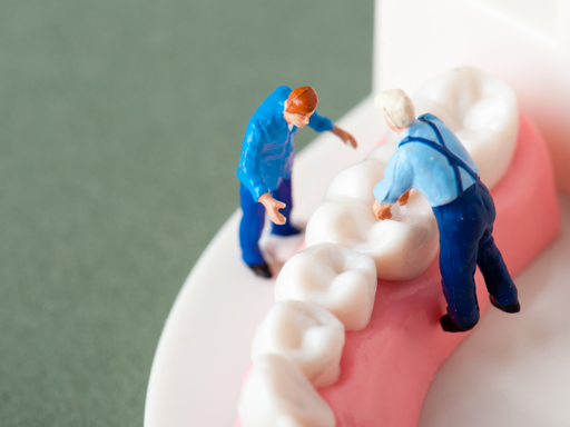 歯の隙間ができる原因とその予防・治療法