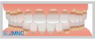 薬物によって変色した歯を白くする治療とは？歯の色と変色の原因について
