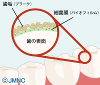 歯をきれいに維持してみませんか？ ティースクリーニング