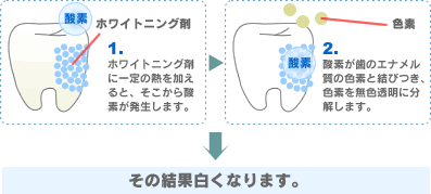 歯を白くする！２つのメカニズム