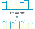 エナメル小柱