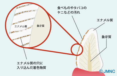 歯の色と変色の原因 -喫煙や飲食物による着色-