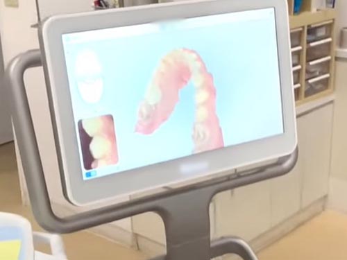 ���Ļ��ʥ���˥å�