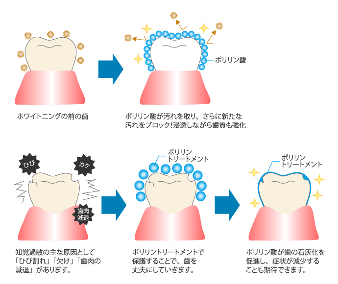 生体成分のひとつ「ポリリン酸 Na」について