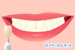 �����򤯤������ʥۥ磻�ȥ˥󥰡�