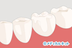 �碌ʪ���򤯤�����