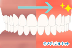 ���Ԥι����ߤ��ꤿ���ʥ���֥꡼����