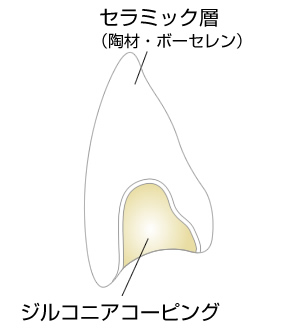 ジルコニアセラミックとは