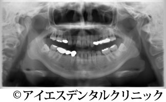 治療前