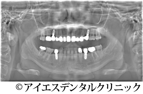 治療後