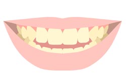 歯の変色や黄ばみが気になる