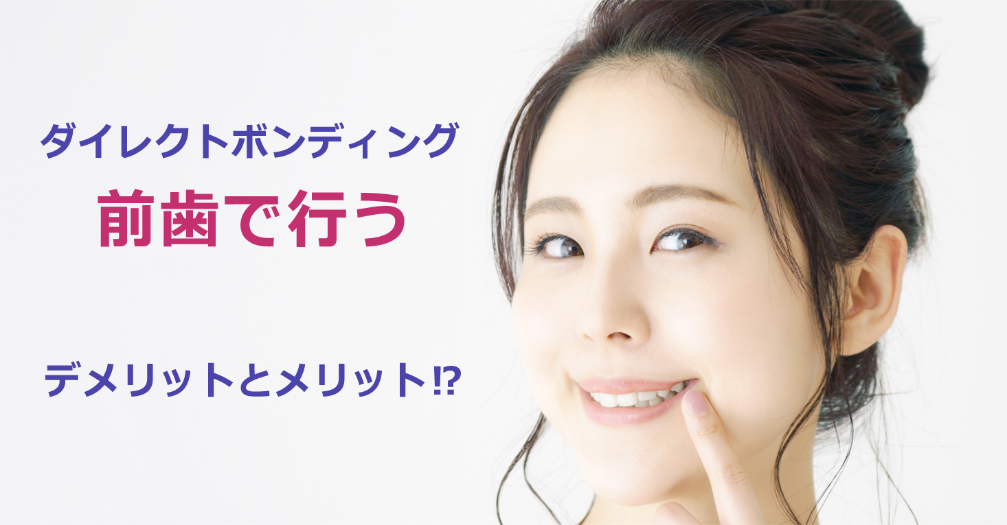 ダイレクトボンディングを前歯で行うデメリットとメリット