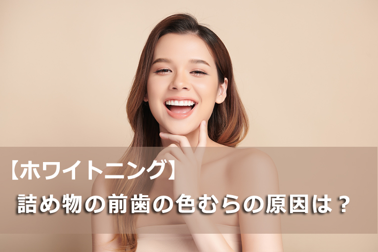 【ホワイトニング】詰め物をしている前歯に色むらができる原因は何？