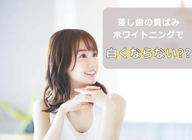 【差し歯の黄ばみはホワイトニングで白くならない？4つの対処法とは？