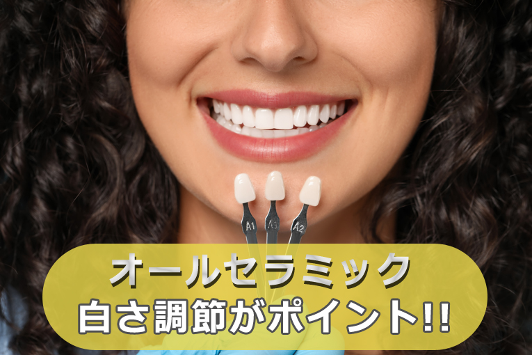 オールセラミックの色味は人気？セラミック治療は白さ調整がポイント