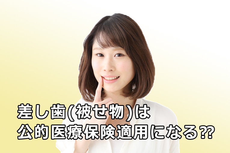 差し歯（被せ物）は公的医療保険適用になる？種類や値段、取れた場合の費用まで解説