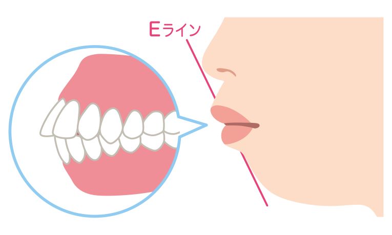 歯ぎしりの治療法・対策