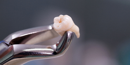 ceramic-orthodontics_img_13