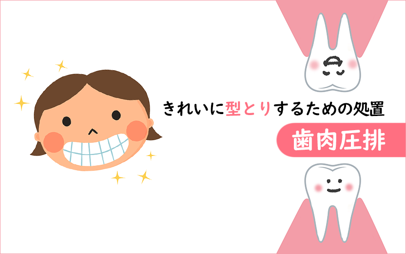 きれいに型とりするための処置「歯肉圧排」