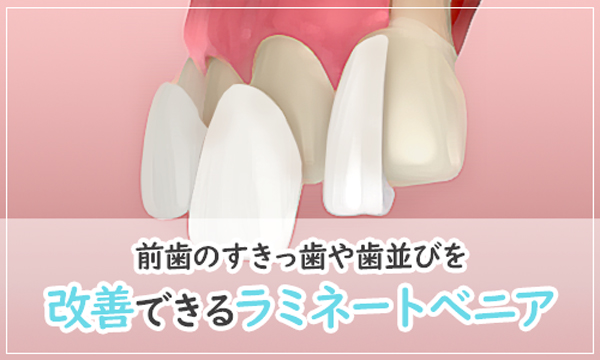 前歯のすきっ歯や歯並びを改善できるラミネートべニア