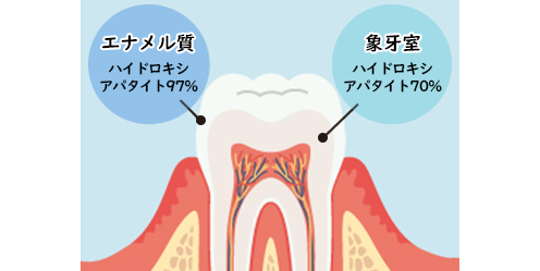 molar-incisor-hypomineralization_img_1