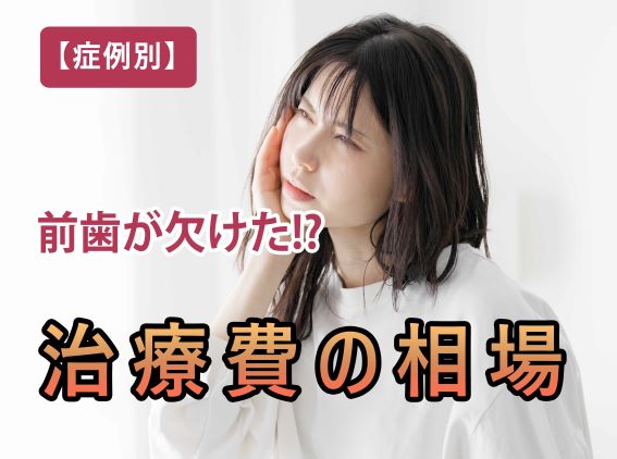 前歯が欠けたときの治療費の相場【症状別】