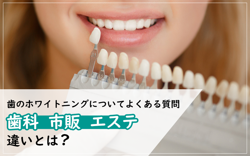 歯のホワイトニングについてよくある質問-歯科、市販、エステの違いとは？