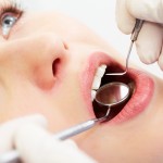 歯のホワイトニングで口臭予防ができるってホント？